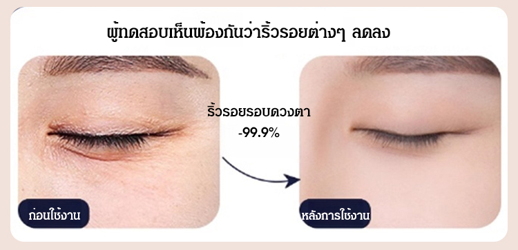 HFH-【重返20岁】龙胆抗皱眼霜_19.jpg