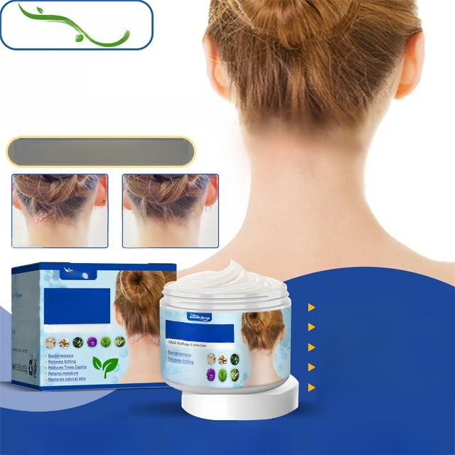 เซาท์มูน ครีมรักษาผิวเซบอร์ไรอิก