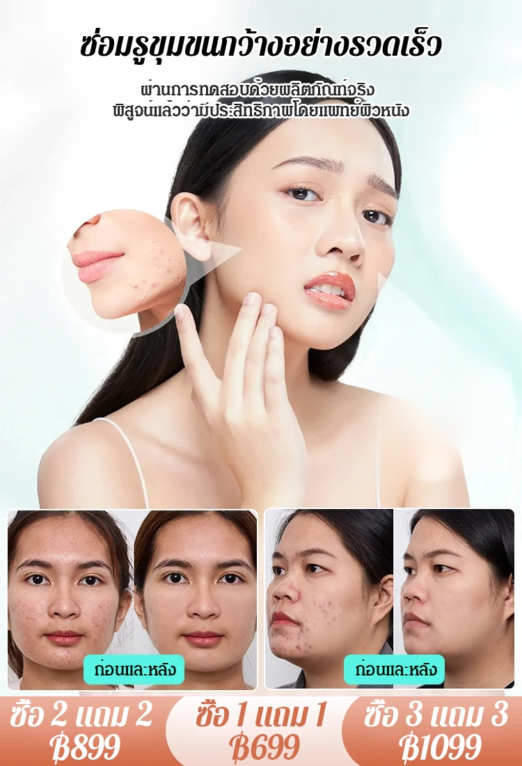 เซรั่มกรดซาลิไซลิก ขจัดเซลล์ผิวเก่าและปรับผิวให้กระจ่างใส