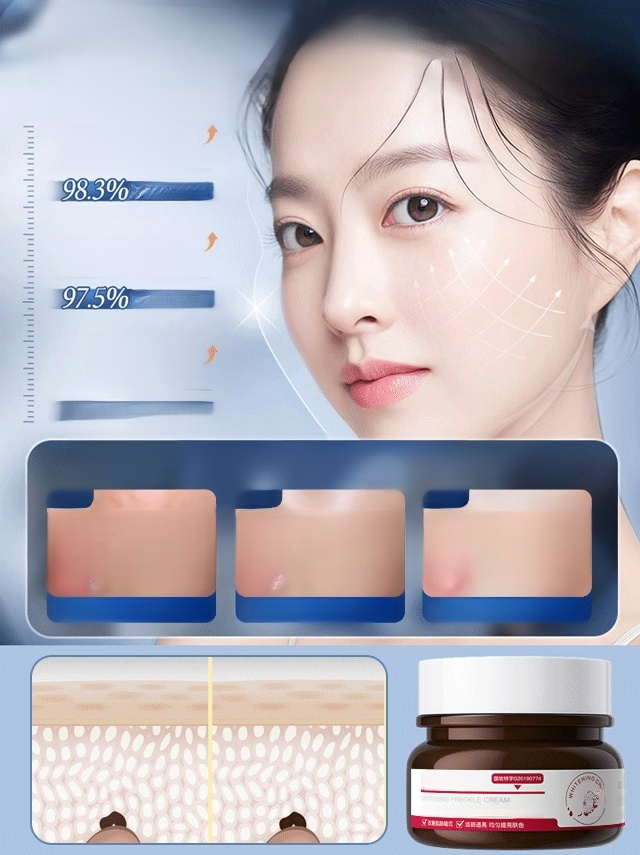 [ไวท์เทนนิ่งและกำจัดกระโดยไม่เกิดซ้ำในเจ็ดวัน] ครีมไวท์เทนนิ่งและกำจัดกระ