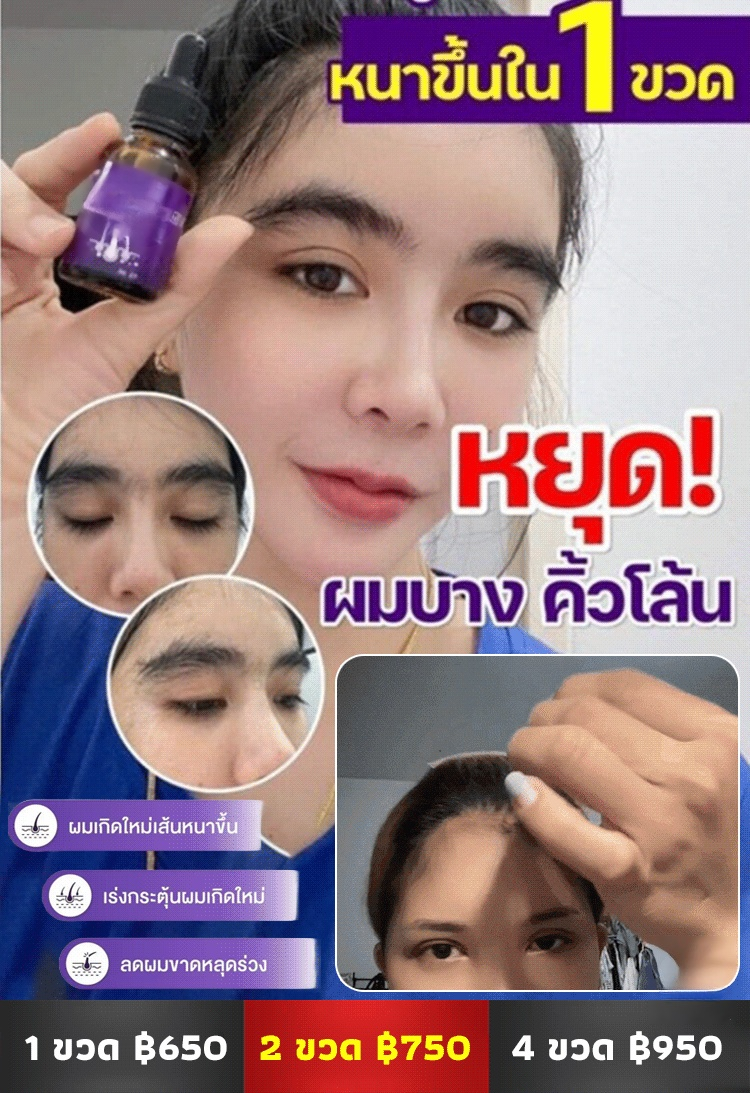 【ผมหนาขึ้น】น้ำมันหอมระเหยปแลูกผมป้องกันผมร่วง