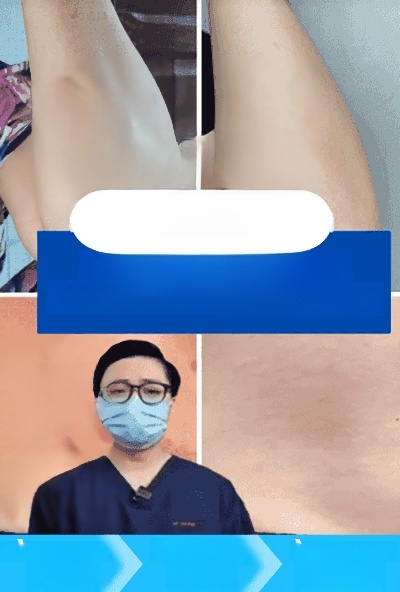 【เห็นผลทันที! รักษาถาวร!】ครีมรักษาโรคด่างขาว