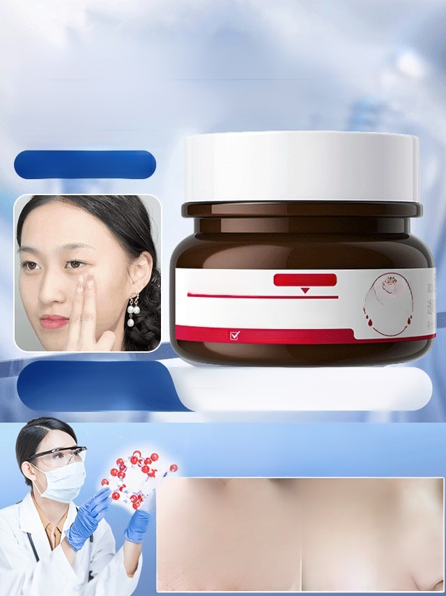 [ไวท์เทนนิ่งและกำจัดกระโดยไม่เกิดซ้ำในเจ็ดวัน] ครีมไวท์เทนนิ่งและกำจัดกระ