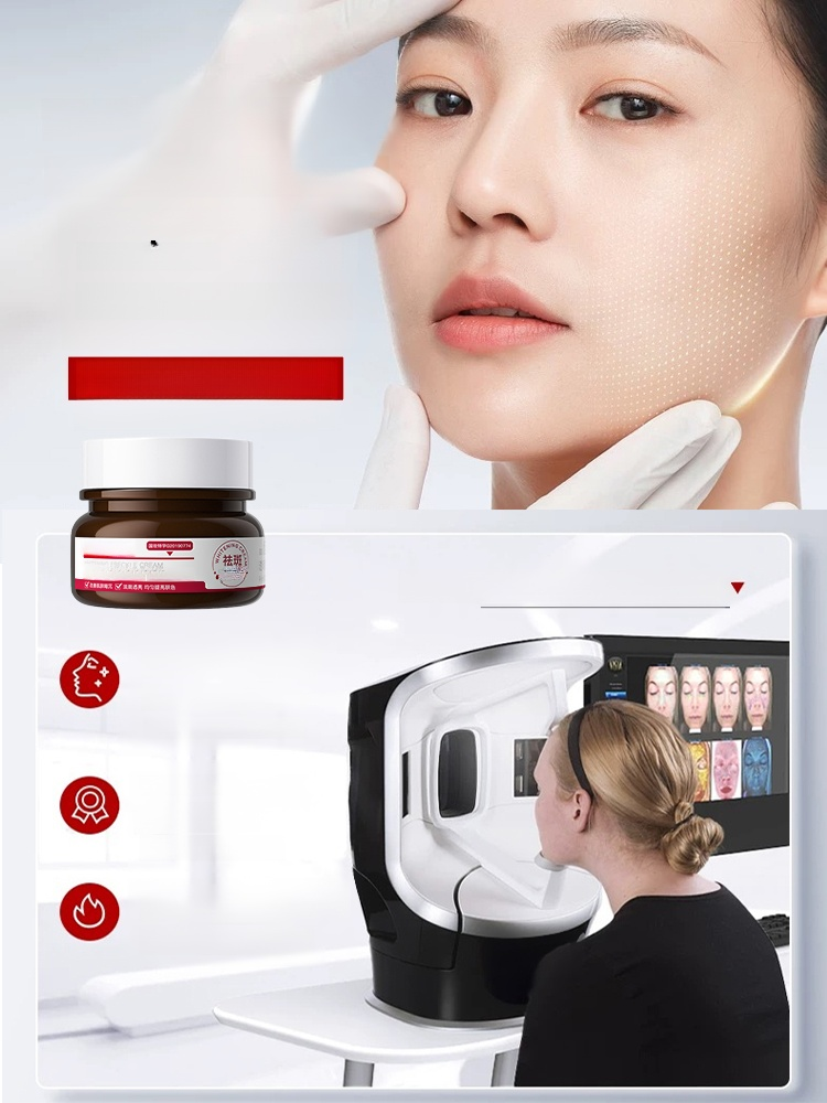 [ไวท์เทนนิ่งและกำจัดกระโดยไม่เกิดซ้ำในเจ็ดวัน] ครีมไวท์เทนนิ่งและกำจัดกระ