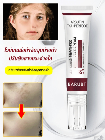 ครีมไวท์เทนนิ่งลดจุดด่างดำ
