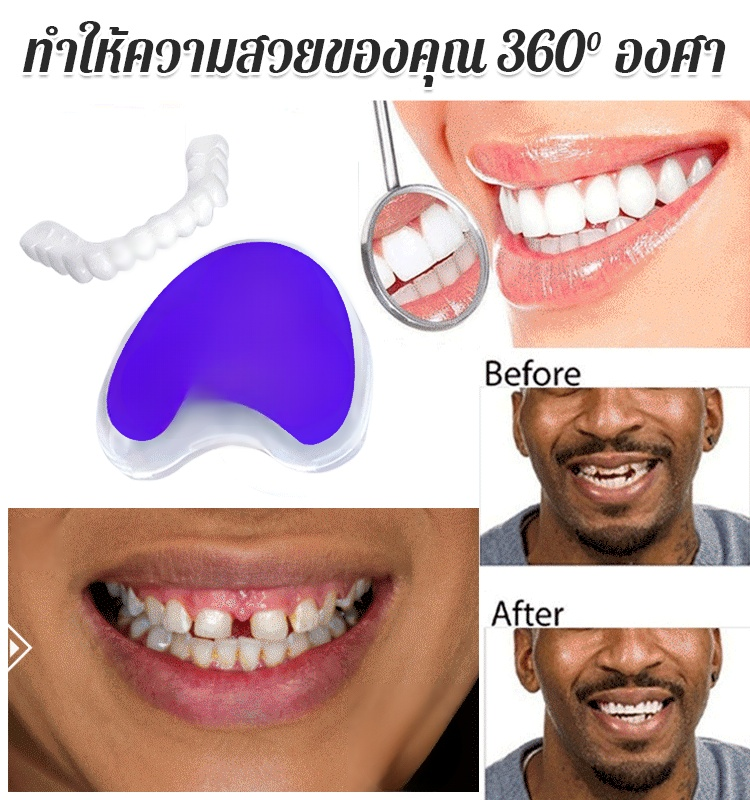 ใหม่ ชุดฟันปลอมเสมือนจริงแบบไม่มีรู