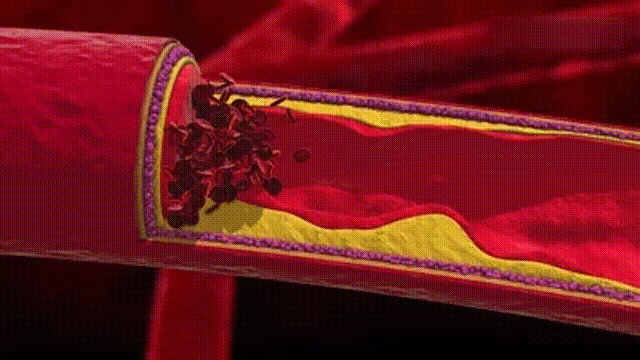 9eb9a39cb79b5fdcecc22e8e443d8127986d7f70.gif