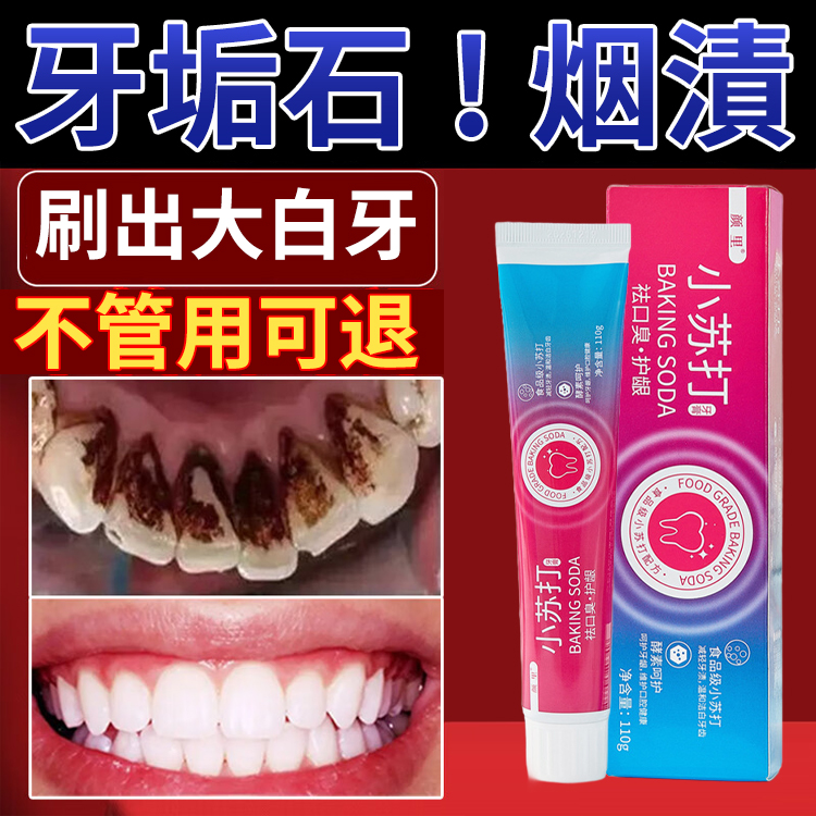 【去口臭護齦】小蘇打酵素美白牙膏