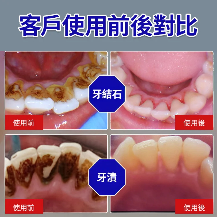 【去口臭護齦】小蘇打酵素美白牙膏
