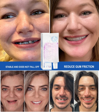 Food-Grade Thermoplastic Denture Adhesive