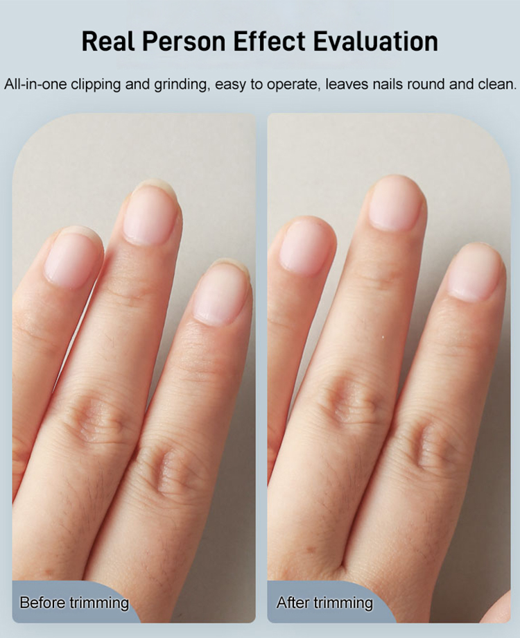 【German Precision】Electric Nail Clipper