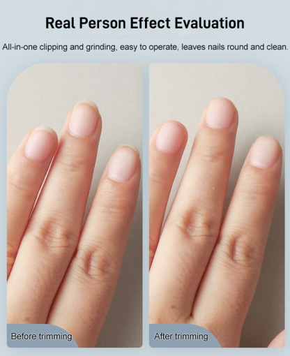 【German Precision】Electric Nail Clipper