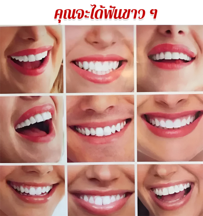 ใหม่ ชุดฟันปลอมเสมือนจริงแบบไม่มีรู