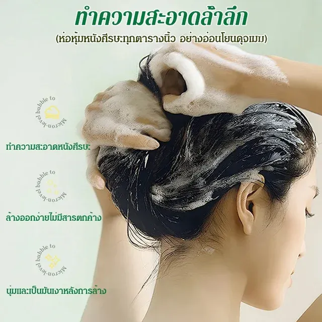 แชมพูคุมมันกำจัดรังแค