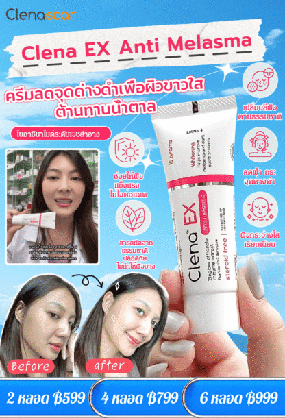 【ลดจุดด่างดำ】ครีมลดฝ้าบำรุงผิวขาวใสสดชื่น