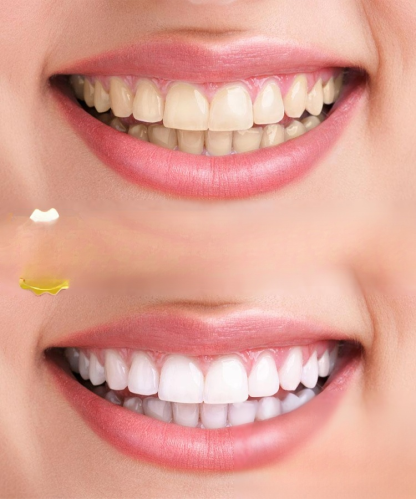 Coconut Mint Whitening Strips