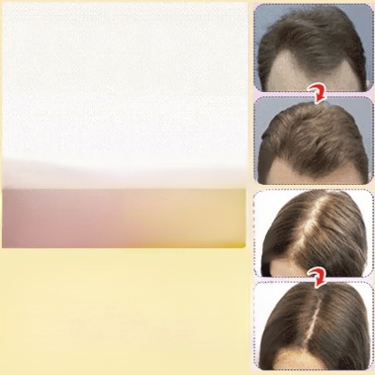 Natural Rosemary Hair Growth Essential Oil