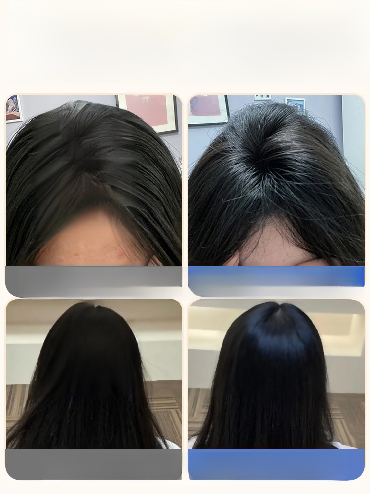 흰머리 커버+머리숱 증가 내추럴 가발