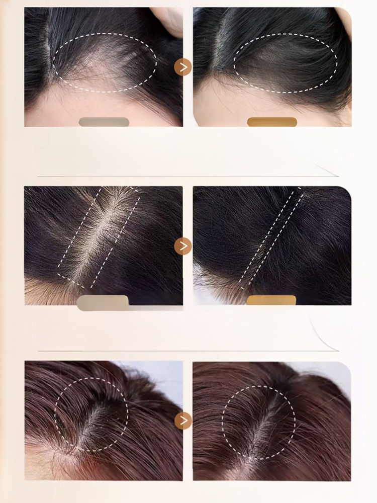 식물성 발모 생강 샴푸