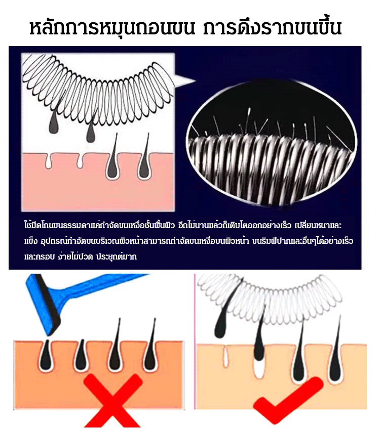สิ่งของจำเป็นสำหรับเสริมหน้าสวย อุปกรณ์กำจัดขนบริเวณผิวหน้า 