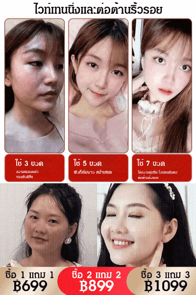 ครีมลดฝ้า กระและทำให้ผิวกระจ่างใส