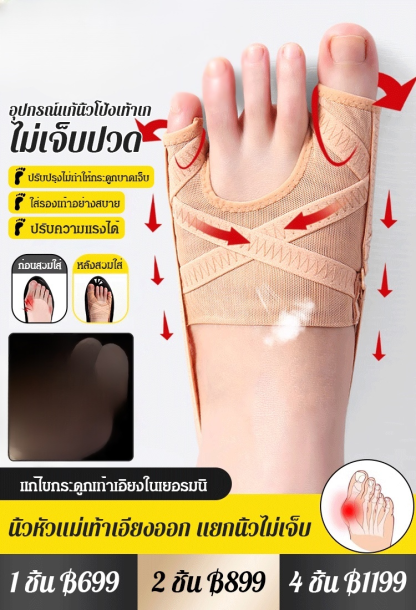 อุปกรณ์แก้นิ้วโป้งเท้าเกผ้าตาข่าย the love 