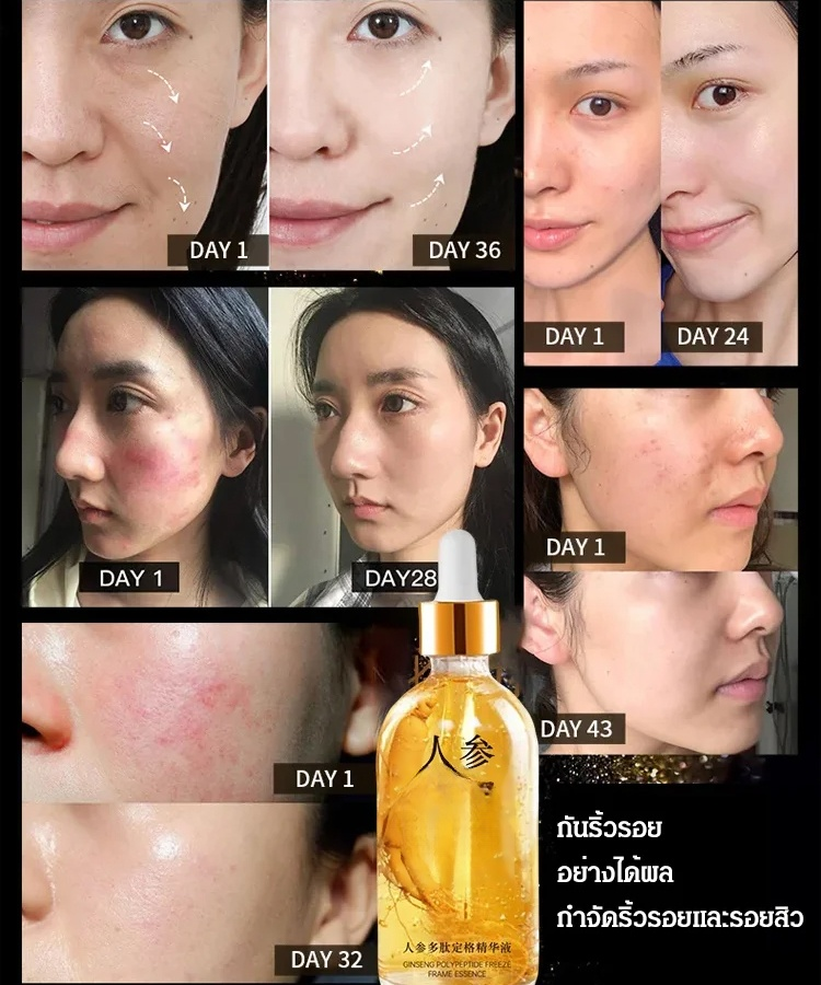 เซรั่มโพลีเปปไทด์โสมรุ่นขายฮิต