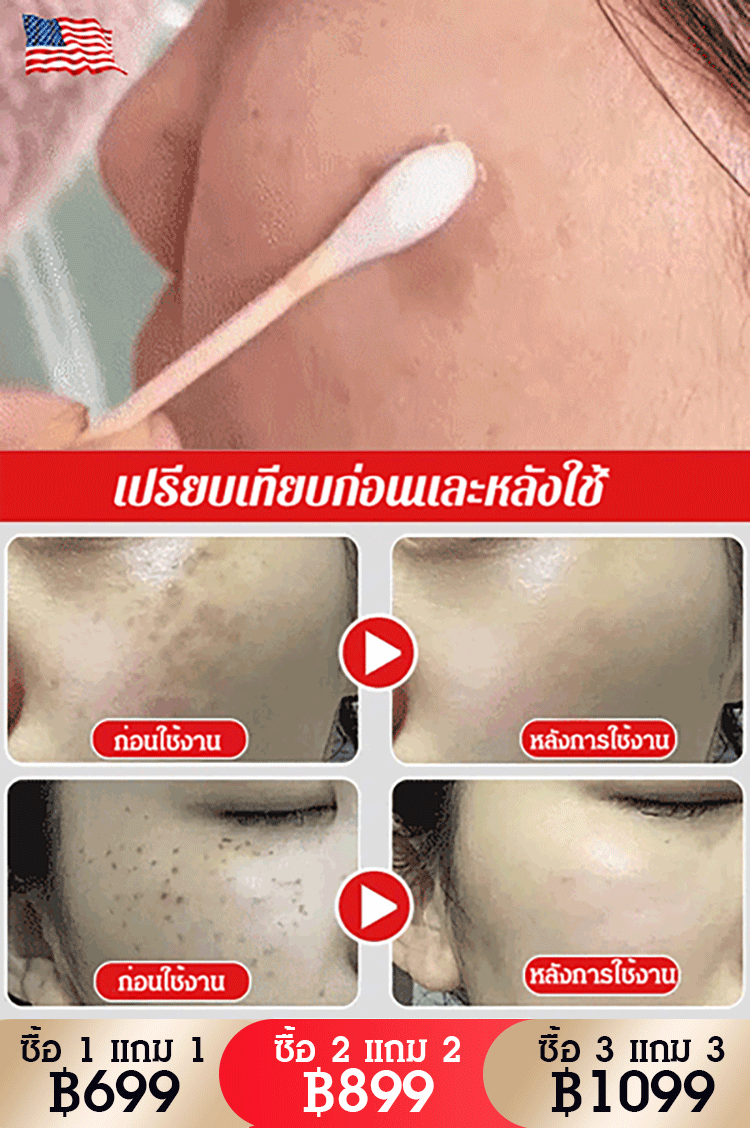 ครีมลดฝ้า กระและทำให้ผิวกระจ่างใส