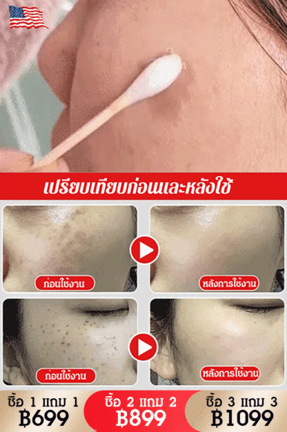 ครีมลดฝ้า กระและทำให้ผิวกระจ่างใส