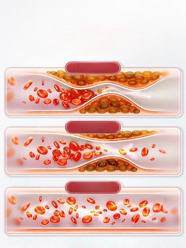 納豆銀杏葉萃取物膠囊