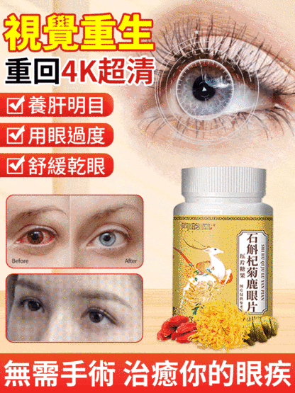 【眼病剋星】石斛杞菊鹿眼片，明目養神，幫助緩解眼部疲勞、維持清晰視力！重現明亮雙眸！
