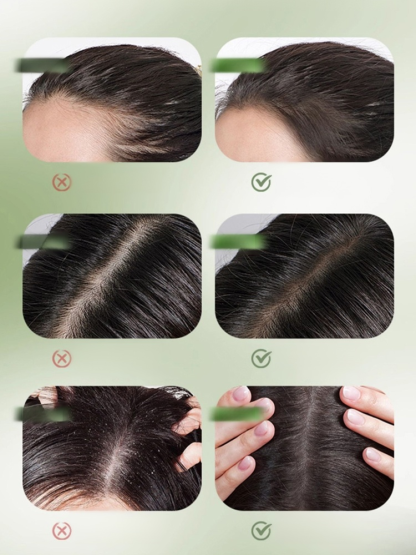 【髪量漲20倍】烏斯曼草側柏葉洗髮皂