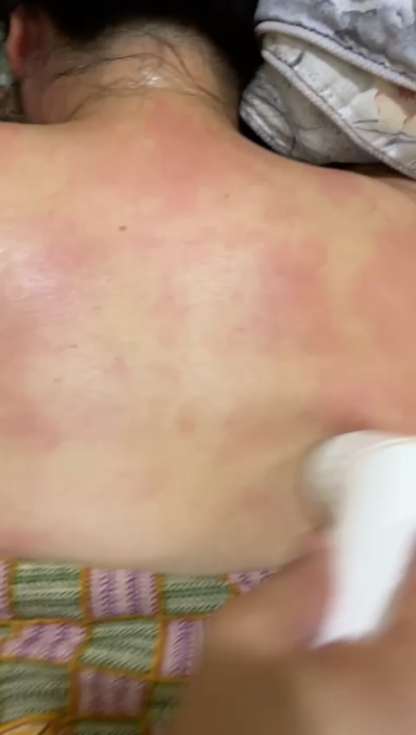 Gaia BianStone Moxibustion Refill Kit: 28 Mugwort Moxa Sticks & Essential Oil