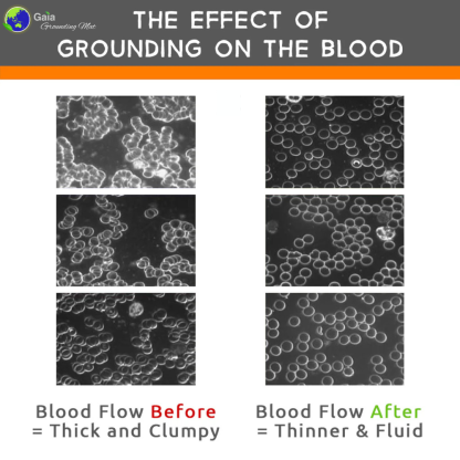 Indoor Touching Green Concept: Gaia Grounding/Earthing Mat. Blood Cells Microscope Screenshots Before and After GroundingA photo showing microscope screenshots of blood cells before and after grounding. This visual comparison highlights the significant health benefits of grounding, such as improved blood circulation and reduced clumping of blood cells. The image demonstrates the powerful effects that grounding can have on the body at a cellular level, supporting better overall health and well-being. 