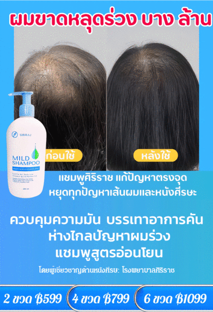 [ขายดีในติ๊กต๊อก】แชมพูป้องกันผมร่วงและแพ้ง่าย
