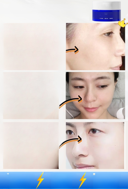 【ทาปุ๊บลดจุดด่างดำ】ครีมยูเรียลดจุดด่างดำ 