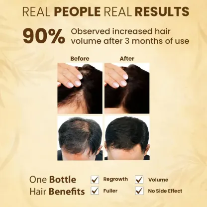Jamalgota Ayurvedic Hair Growth Powder_ Buy 1 Get 1 Free @ Just Rs.599/-