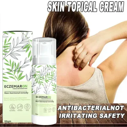 Eczemaron Anti Fungal Cream V Spray_Buy 1 Get 1 Free @ Just Rs.599/-