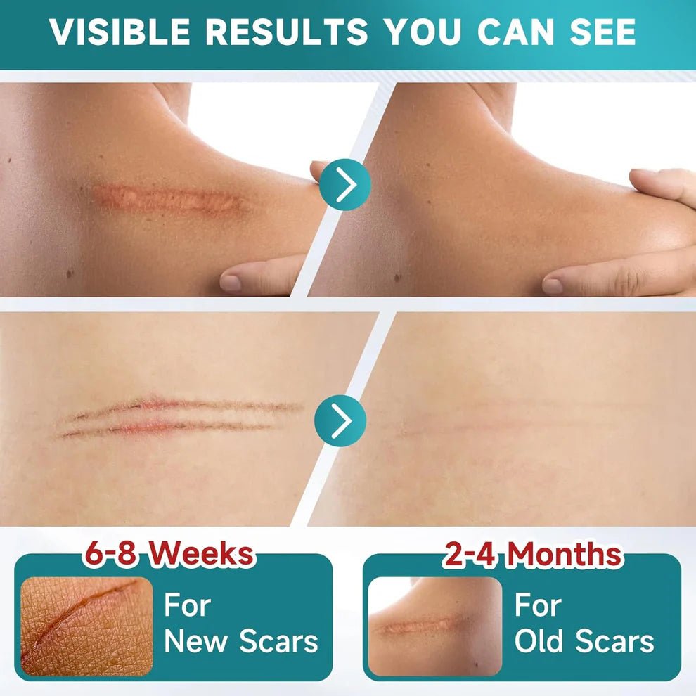 Fast Results