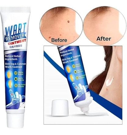 Wart Remover Gel_Buy 1, Get 1 Free @ Just Rs.499/-