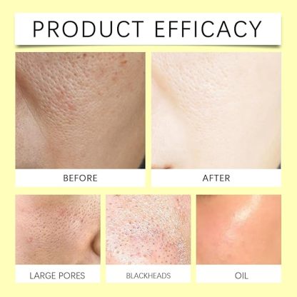Kojic Acid and Turmeric Cleansing Pads @ Just Rs.499/-