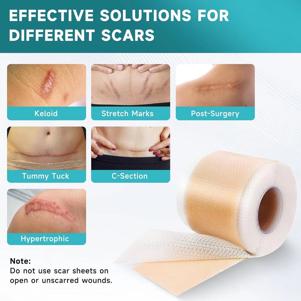Works on All Scars