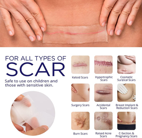Safe For All Skin