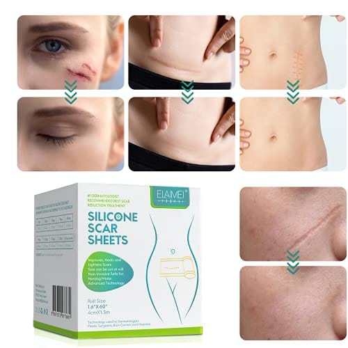 Silicone Scar Removal Tape @ Just Rs.599/-