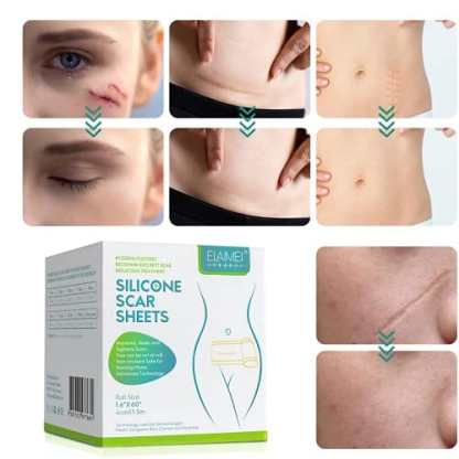 Silicone Scar Removal Tape @ Just Rs.599/-