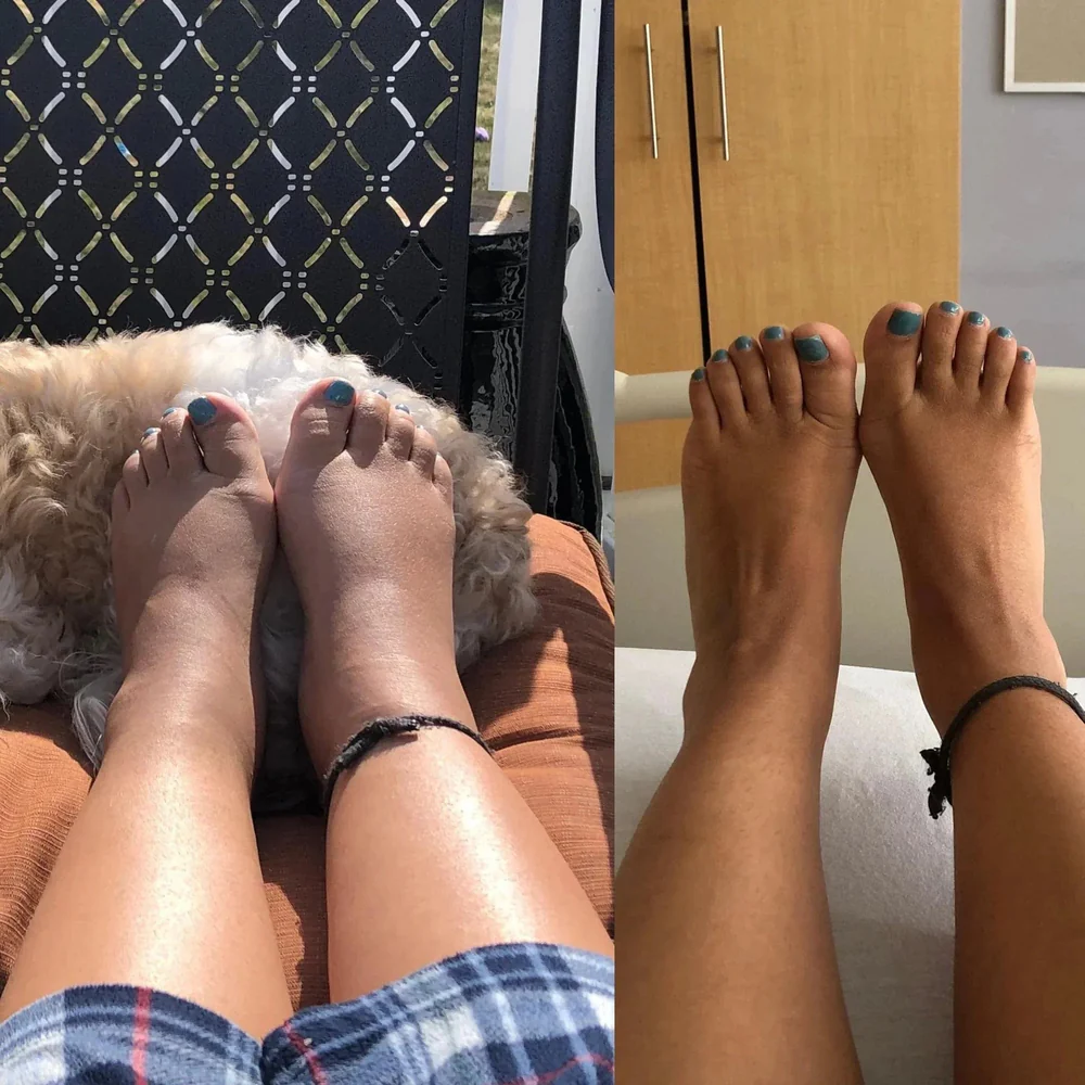  Compression Socks, Compression Socks for Women, Neuropathy Socks, Arch Support, Foot & Ankle Swelling, Achilles Tendon, Heel Pain, Injury Recovery