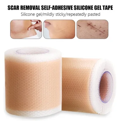 Silicone Scar Removal Tape @ Just Rs.599/-