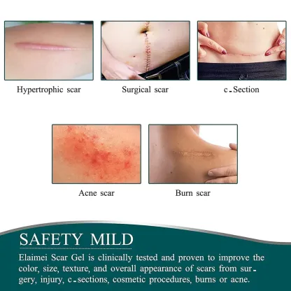 Silicone Scar Removal Tape @ Just Rs.599/-