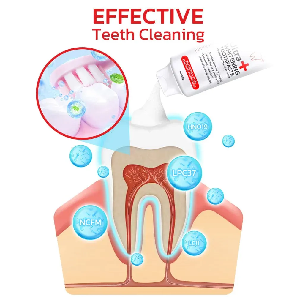 SP 4 Ultra Brightening Toothpaste Advanced Whitening Formula @Just Rs.499/-