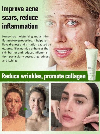 Effortlessly Shed a Layer of Skin! Popular Exfoliating Gel in Japan and Korea